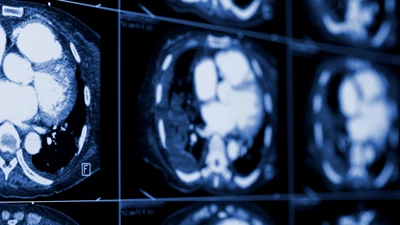 Fremtidens bildediagnostikk - 35946