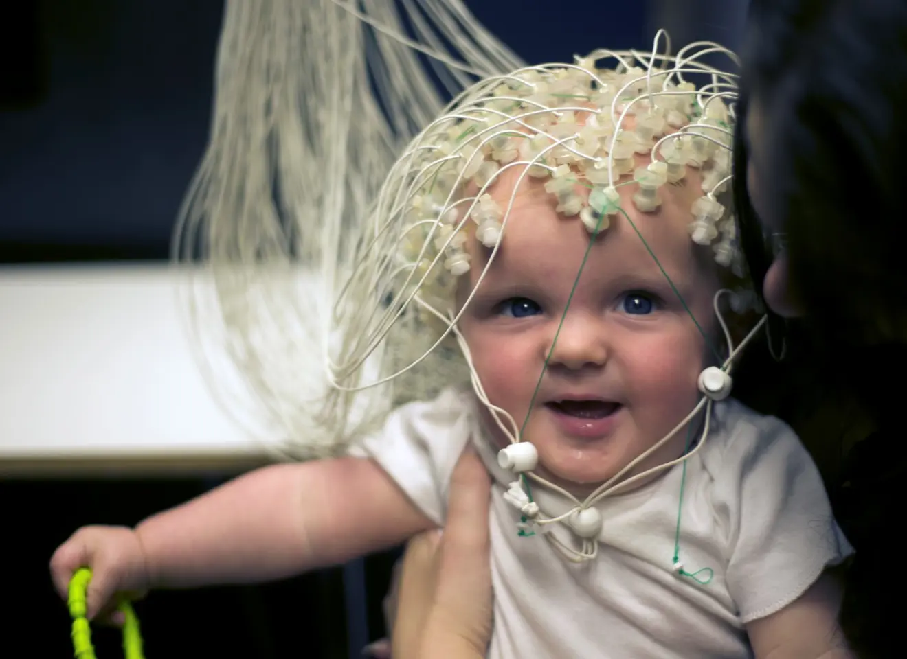 Illustrasjonsbilde av et baby med mange sensorer av en EKG-maskin eller lignende på hodet