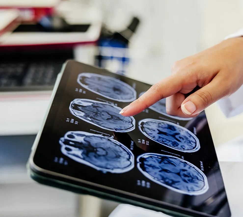 Skjerm med MRI-resultater av en skannet hjerne