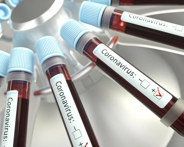 Illustrasjonsbilde av blodprøver hvor det står Coronoavirus på prøveflaskene.