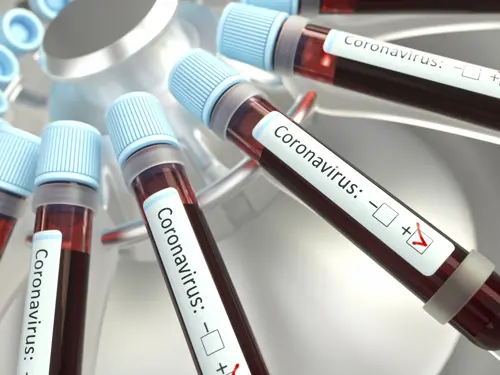 Illustrasjonsbilde av blodprøver hvor det står Coronoavirus på prøveflaskene.